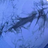 Galaxy Wonderland Tie-Dye Active Leggings
